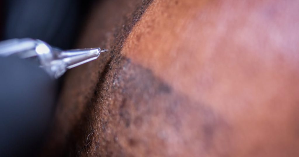 Micropigmentación capilar en Santander