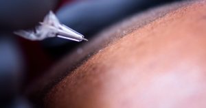 Micropigmentación capilar en Santander