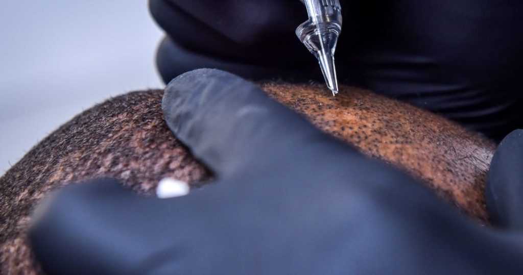 Tendencias en micropigmentación y estética en 2025